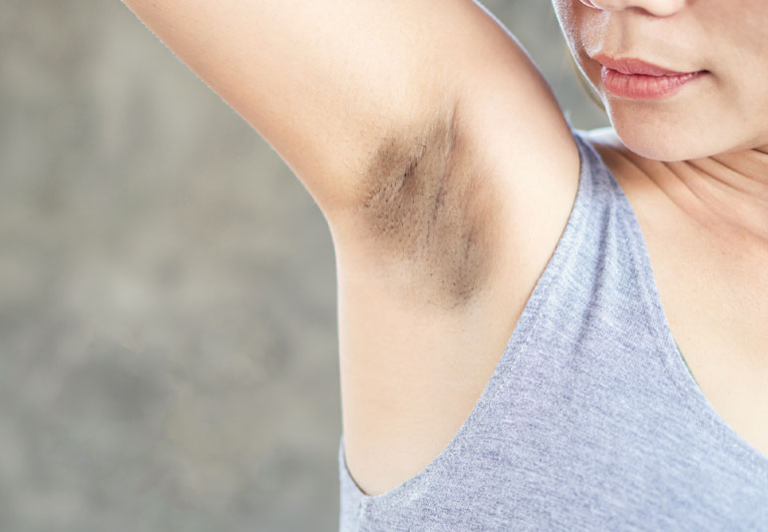 how to reduce underarm dark spots naturally