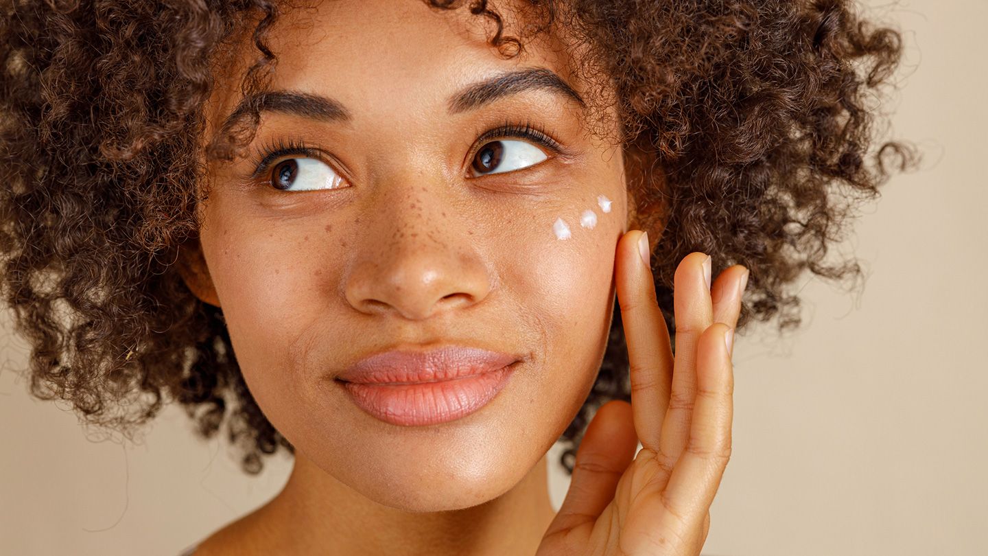 How to treat hyperpigmentation naturally