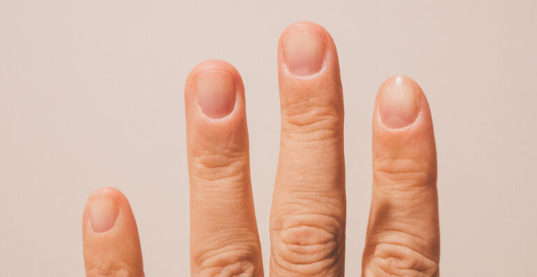 How to strengthen brittle nails naturally