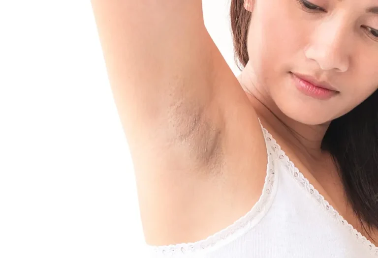 Natural ways to lighten underarms at home