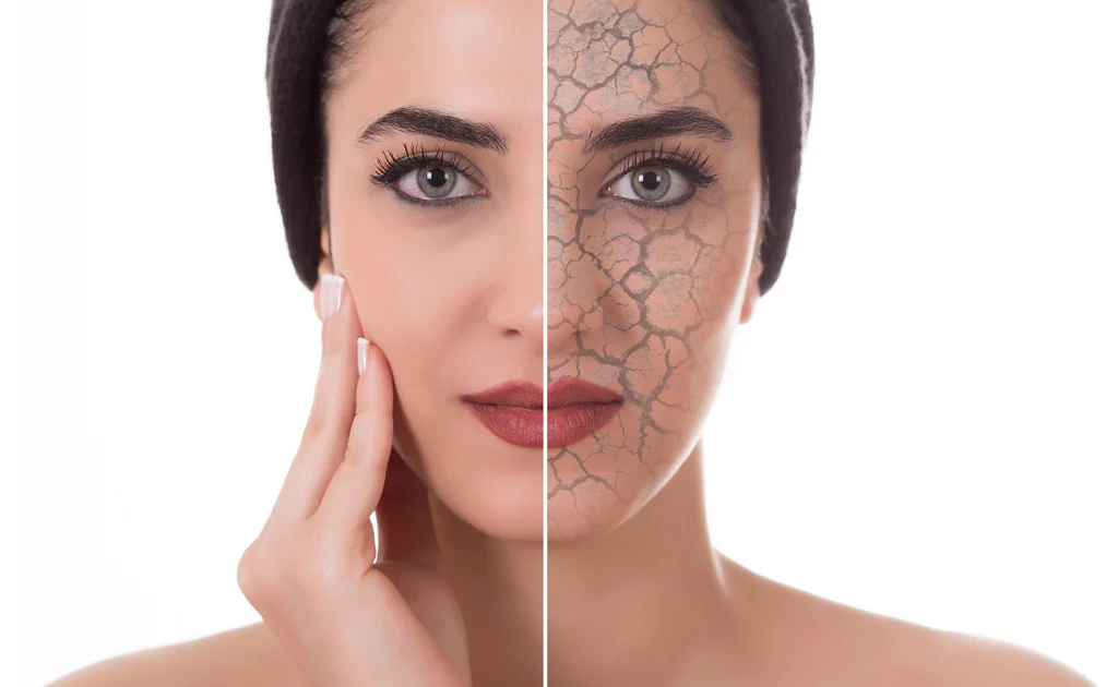 how to fix damaged skin barrier naturally
