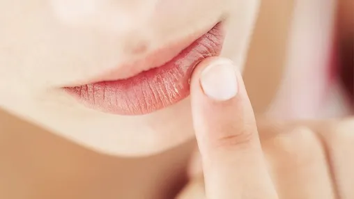 Natural remedies for dry and chapped lips