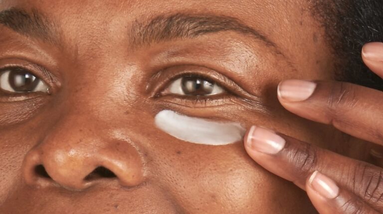 How to reduce fine lines around eyes naturally