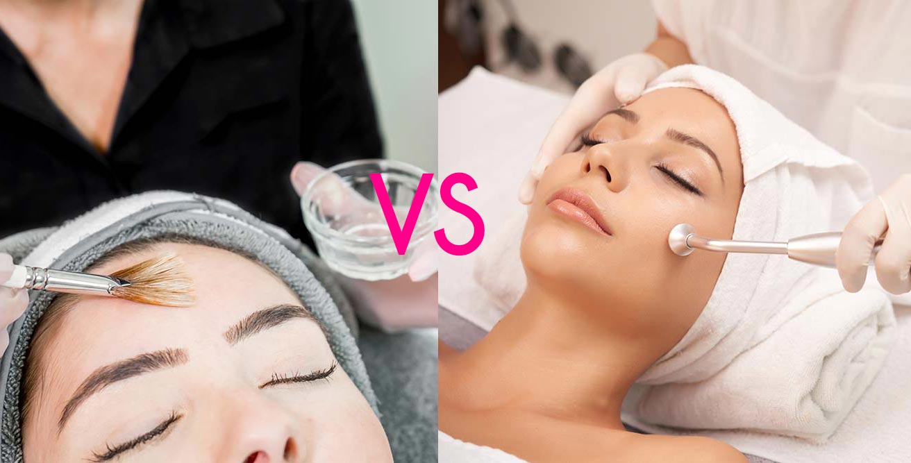chemical peel vs microdermabrasion for acne scars