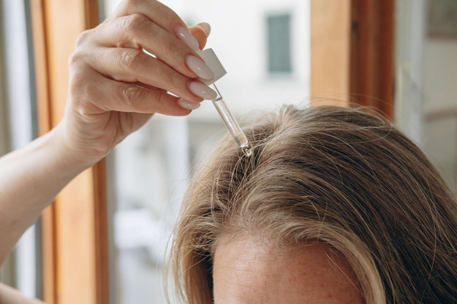 scalp treatment for dandruff and itching