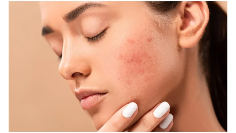how to reduce dark spots on face naturally