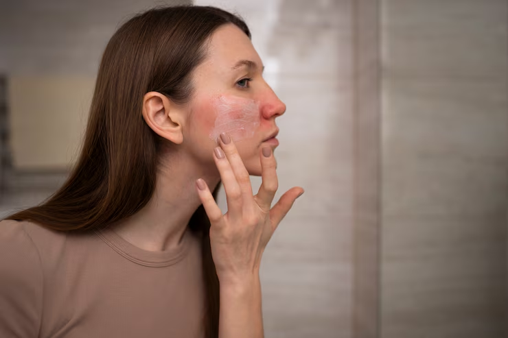 how to take care of sensitive skin without irritation daily