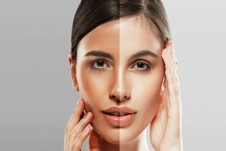 How to naturally lighten skin tone fast