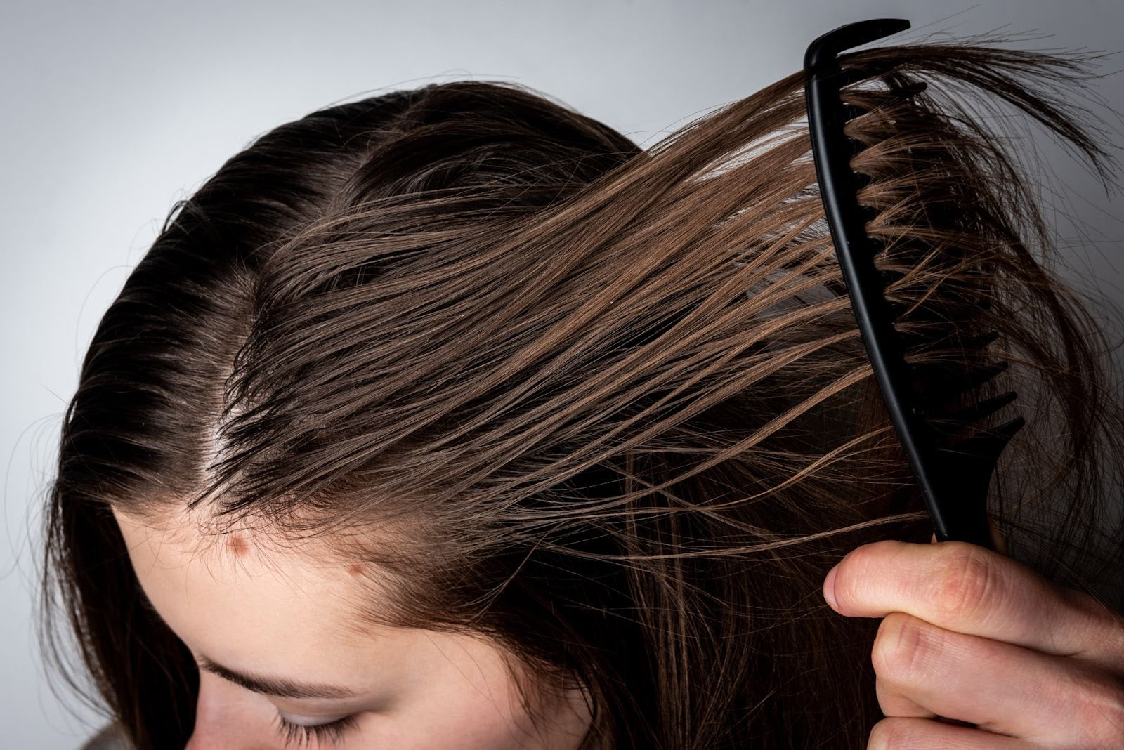How to treat oily scalp and hair naturally