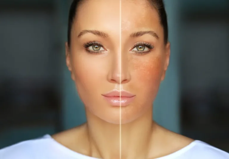 Natural remedies for dark spots and uneven skin tone