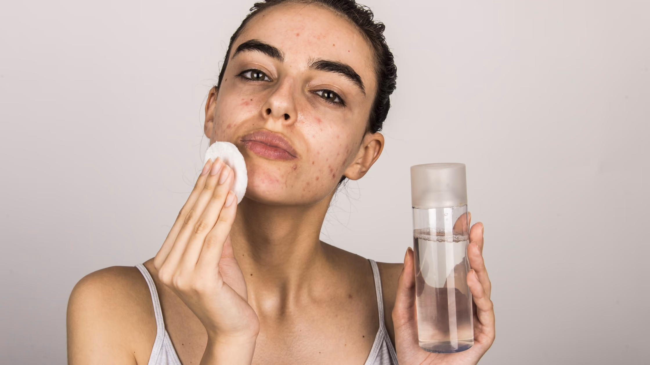 best skincare routine for acne-prone skin at home