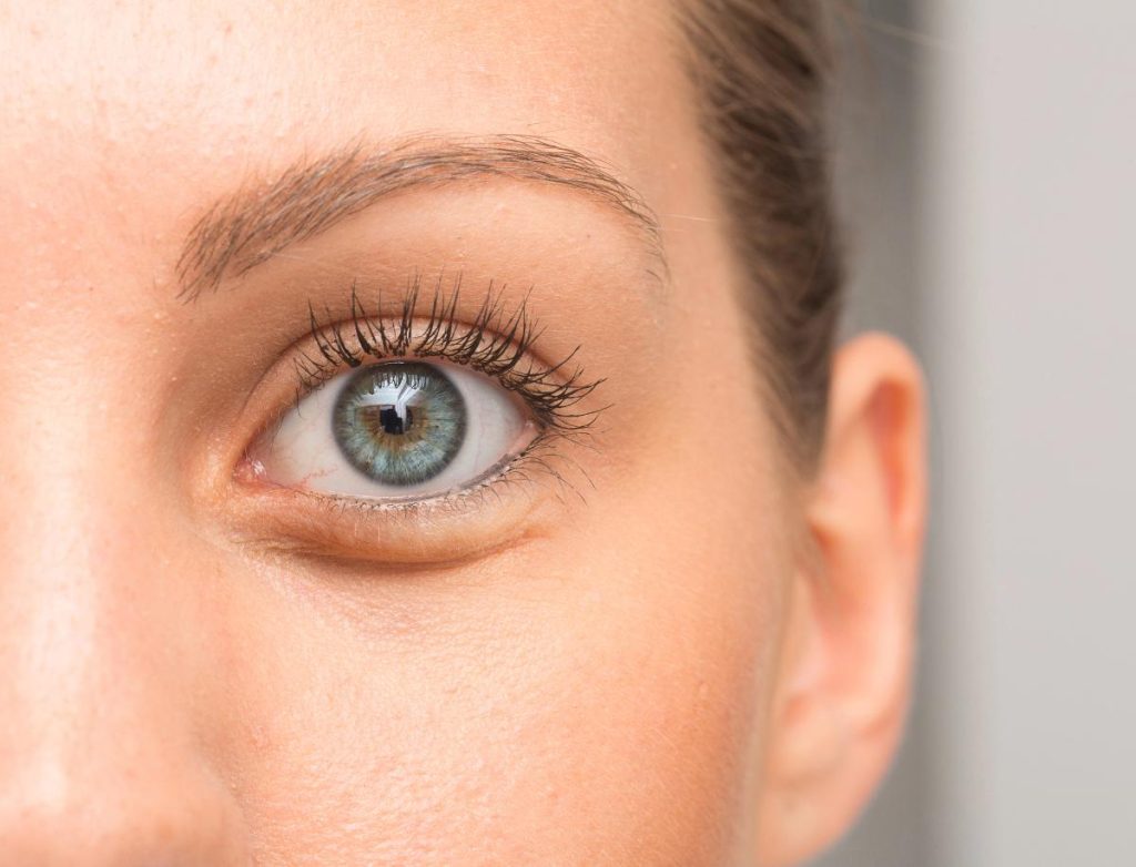 beauty strategies for reducing tired-looking eyes without concealer