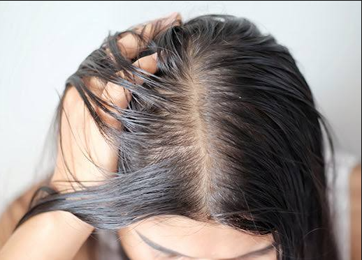 Hair growth tips for women with thin hair