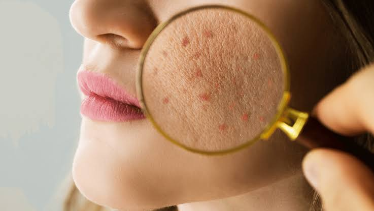 Common skincare mistakes that damage your skin