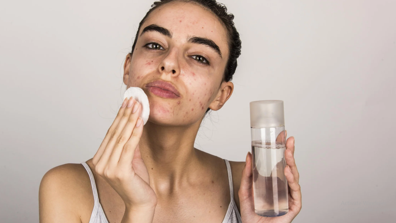 Best skincare routine for oily and acne-prone skin