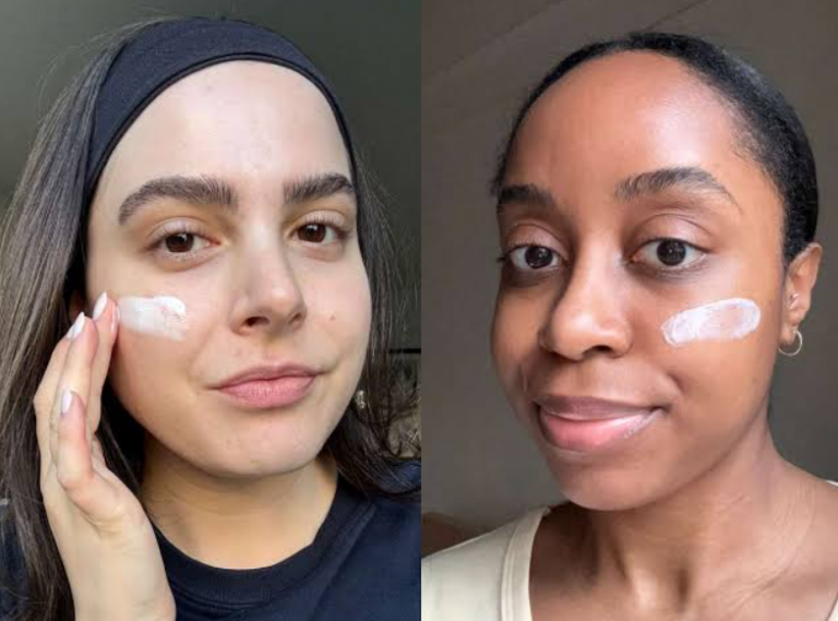 Best moisturizer for dry sensitive skin
